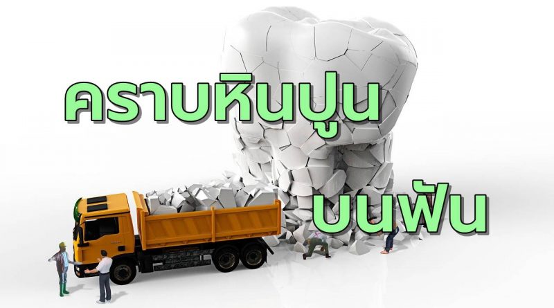คราบหินปูนเกิดขึ้นได้อย่างไร