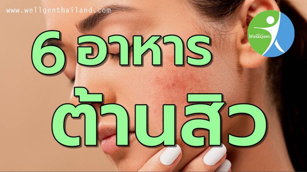 6อาหารต้านสิวลดรอยดำ