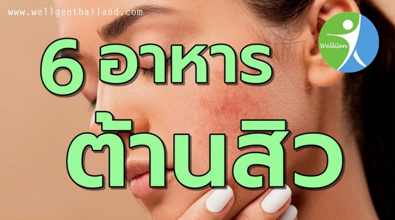6อาหารต้านสิวลดรอยดำ