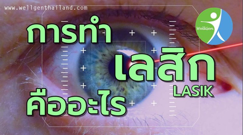 การรักษาภาวะสายตาผิดปกติด้วยเลสิกคืออะไร