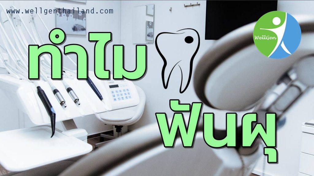 ทำไมฟันผุเกิดจากอะไร