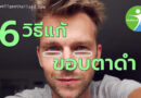 6วิธีแก้อาการขอบตาดำคล้ำ
