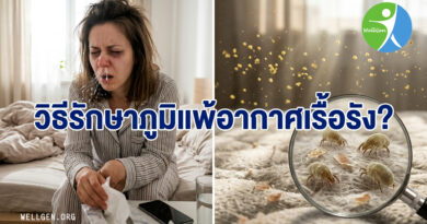 5 ความลับของ “ภูมิแพ้อากาศ” ที่คุณอาจไม่เคยรู้: จากรอยคล้ำใต้ตาถึงนวัตกรรมการรักษาให้หายขาด