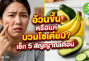 อ้วนขึ้นหรือแค่บวมโซเดียม เช็ก5สัญญาณเตือน