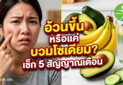 อ้วนขึ้นหรือแค่บวมโซเดียม เช็ก5สัญญาณเตือน