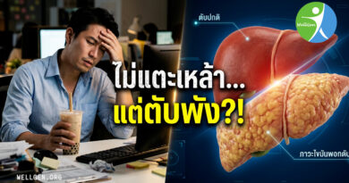 5ความจริงสุดเซอร์ไพรส์เกี่ยวกับไขมันพอกตับ