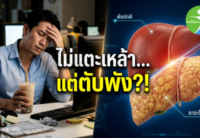 5ความจริงสุดเซอร์ไพรส์เกี่ยวกับไขมันพอกตับ
